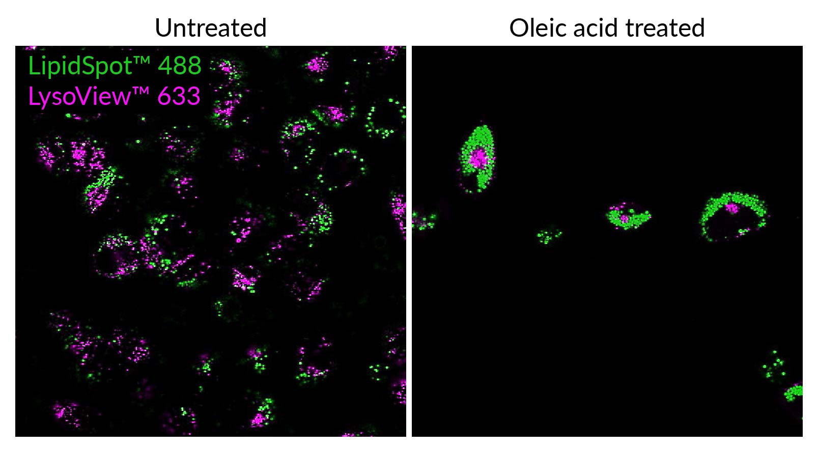 LipidSpot™ Lipid Droplet Stains - Image 4