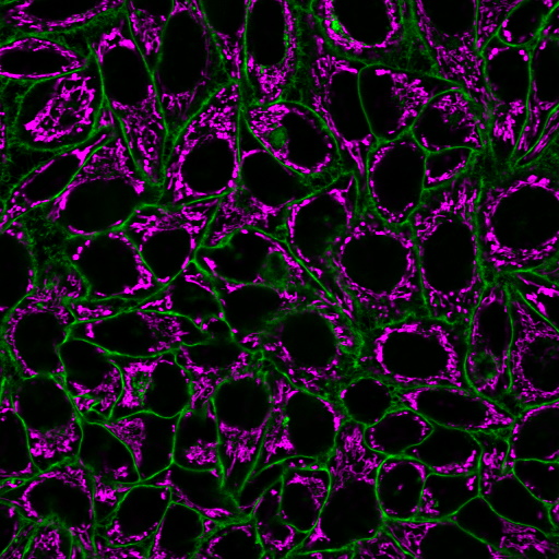 CellBrite® Steady Membrane Staining Kits - Image 8