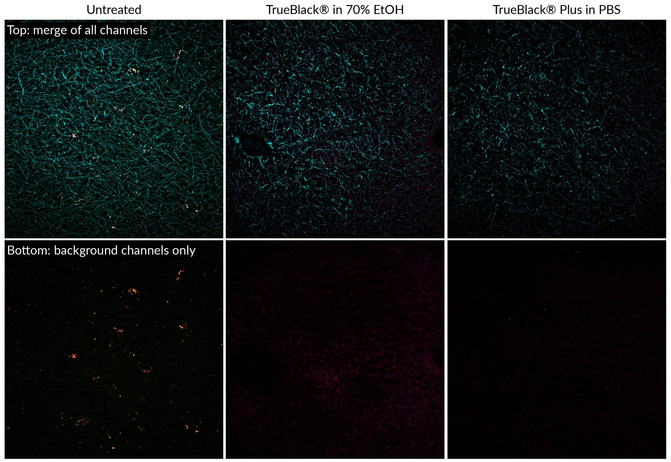 TrueBlack® Plus Lipofuscin Autofluorescence Quencher, 40X in DMSO - Image 3