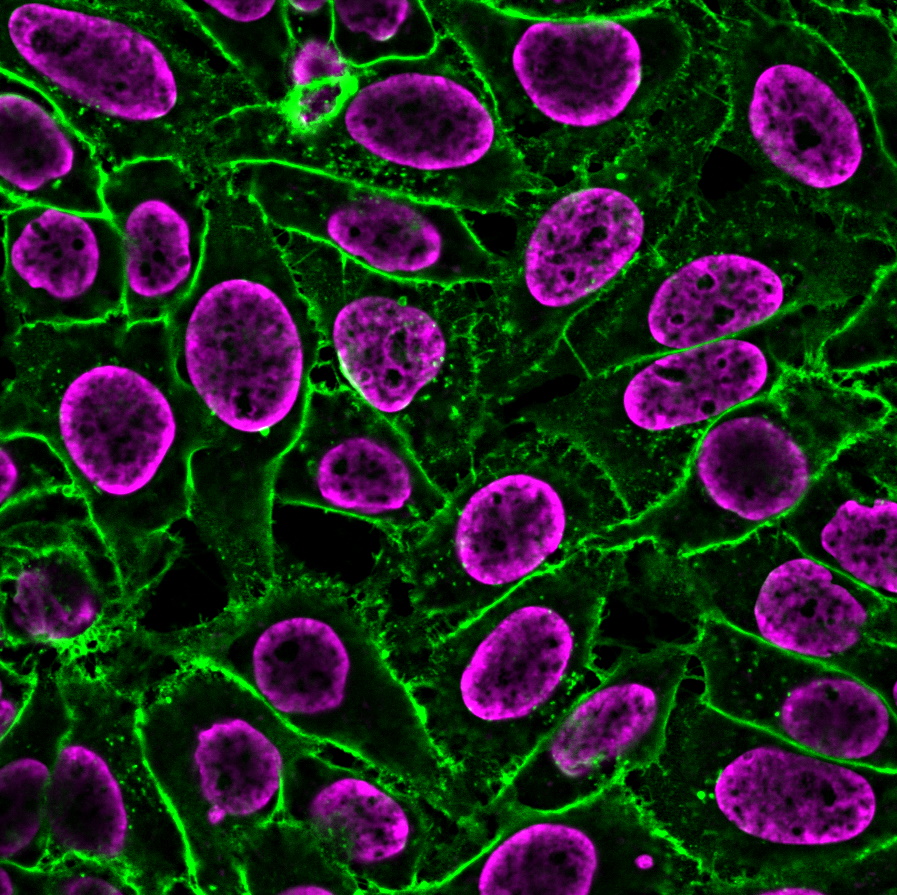 EverBrite™ Hardset Mounting Medium with NucSpot® 640 - Image 3