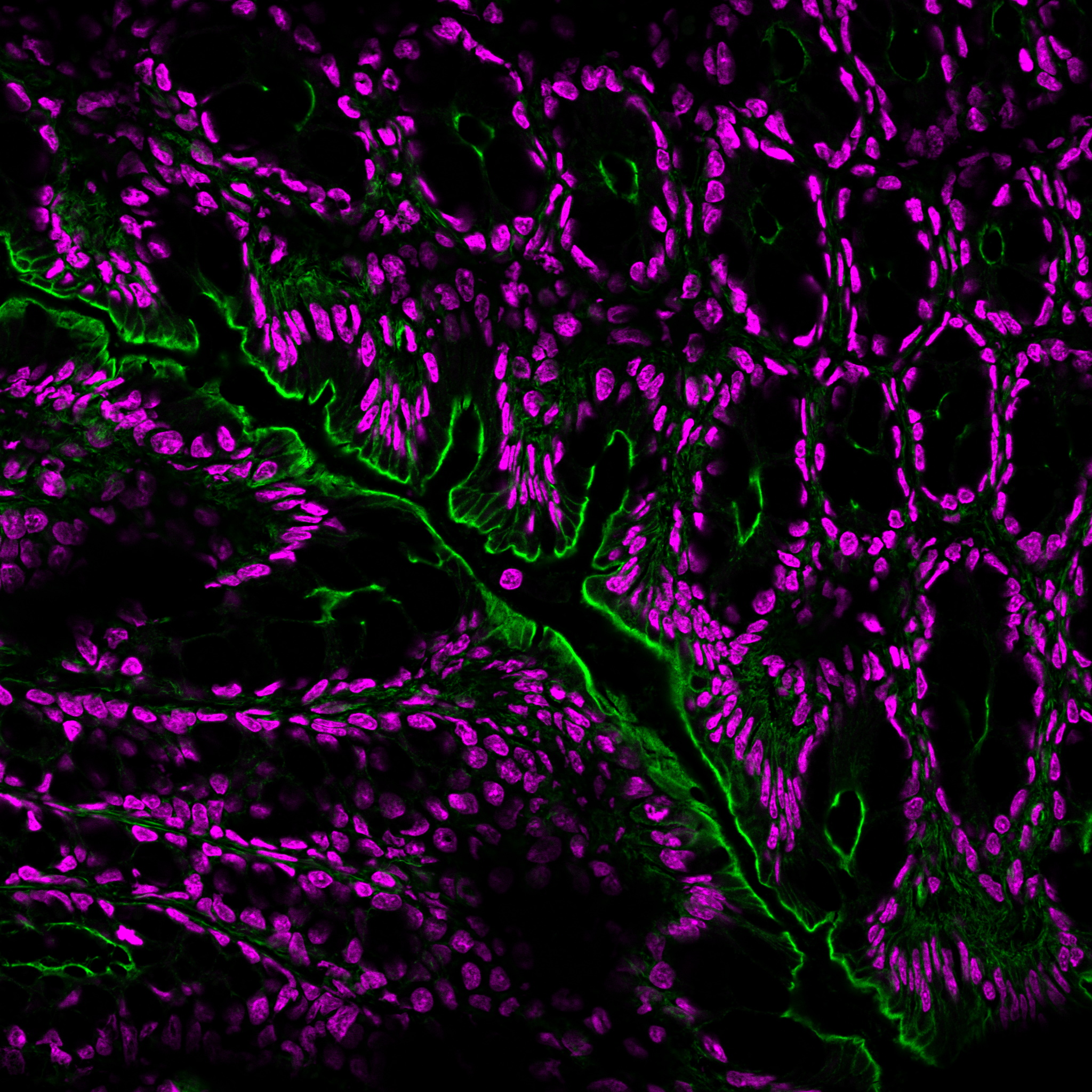 EverBrite™ Hardset Mounting Medium with NucSpot® 640 - Image 4