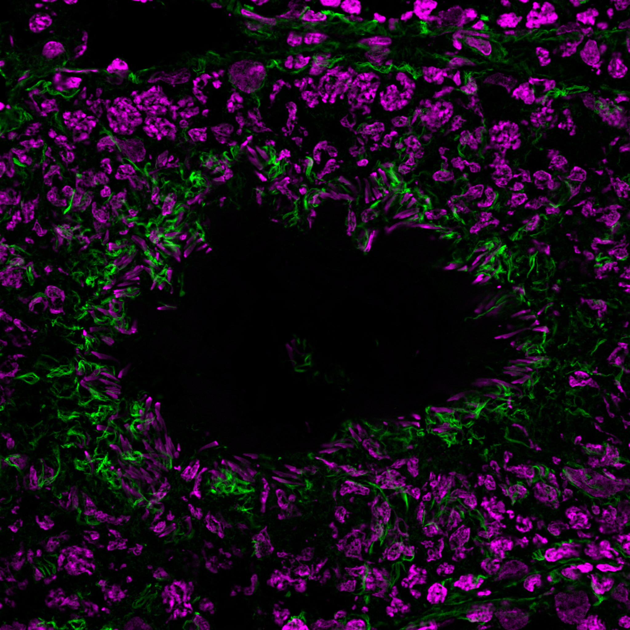 EverBrite™ Hardset Mounting Medium with NucSpot® 640 - Image 6