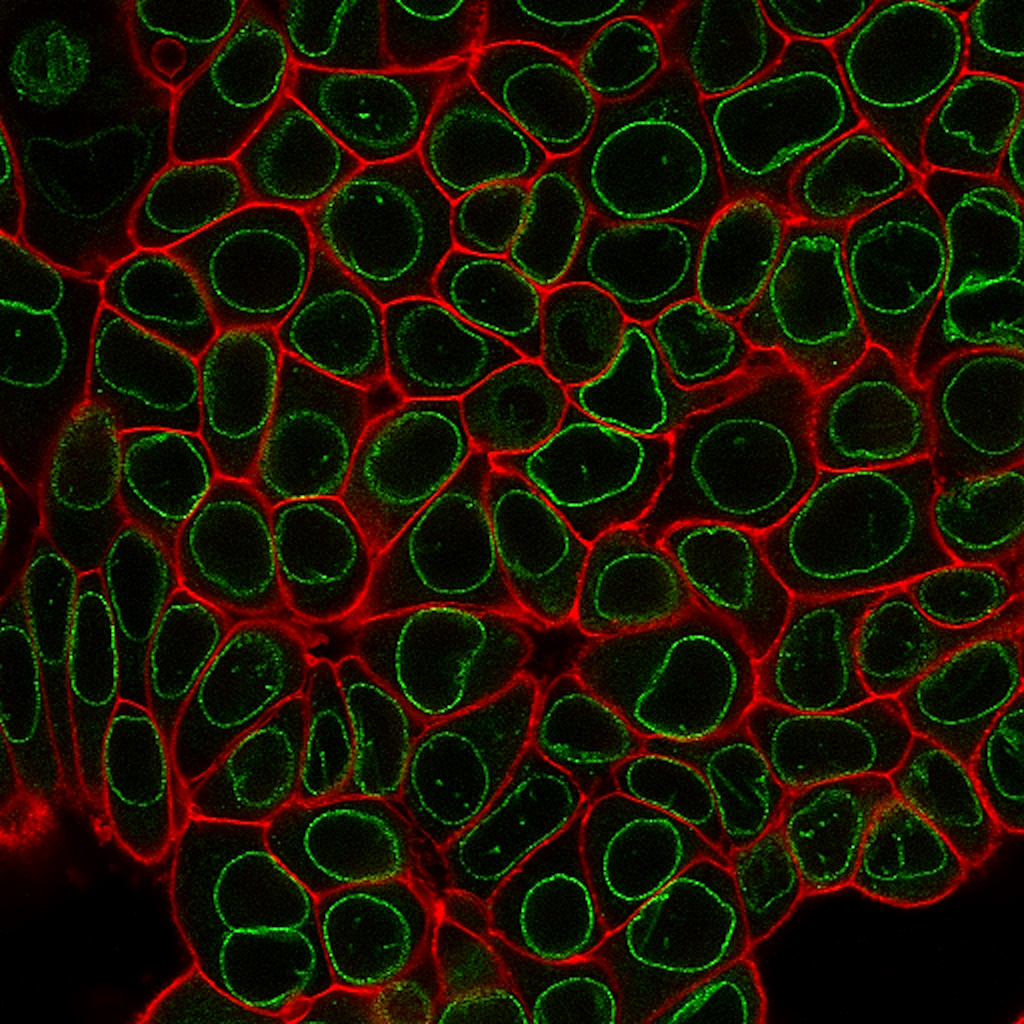 CytoLiner™ Fixed Cell Membrane Stains - Image 7