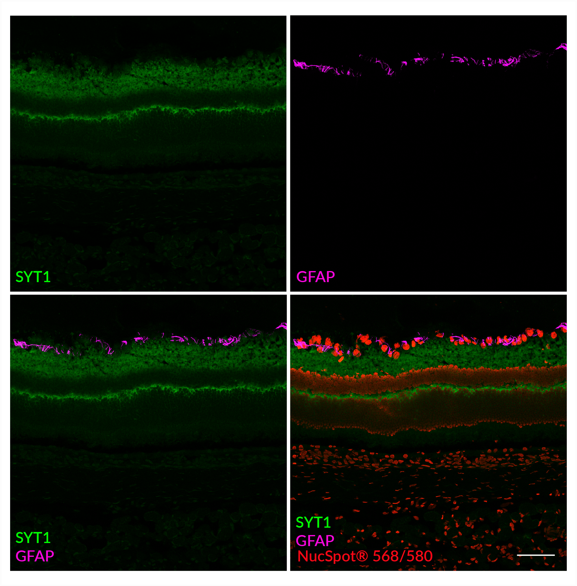 SYT1 Recombinant Alpaca VHH (SdAb2501.SYT1) - MiniMab™<svg class="svgicon svg-verified"><use xlink:href="#svg-verified"></use></svg> - Image 2